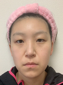 KMさん before